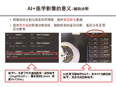 AI读片1秒辨肿瘤，南京医院CT检查先过机器人关-第2张图片-世界杯直播-世界杯直播观看-官方最新链接-V3.6.9